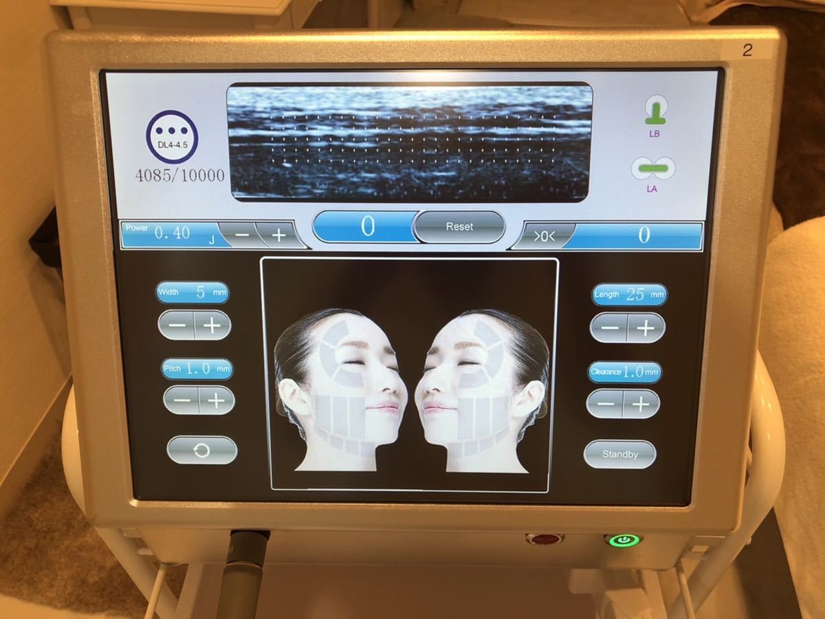 HIFU ハイフ フェイシャル＆ボディウルセラ スマス業務用美容機器エステマシン ウルセラリフト（全顔220,000円）の値段・効果・副作用・ダウンタイム