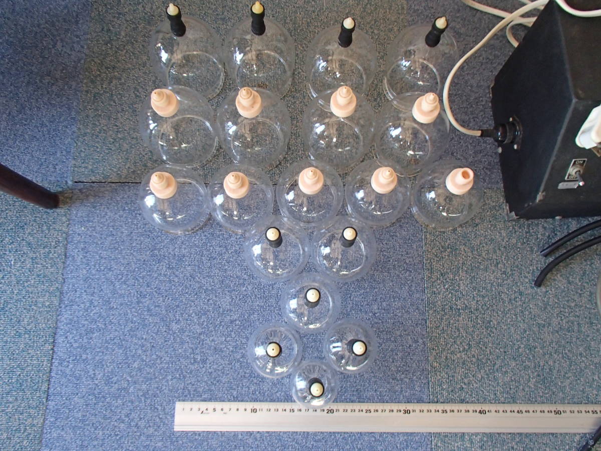ガラスカッピングと吸引器 電気真空浄血治療器バンキーSR（健康医学社）