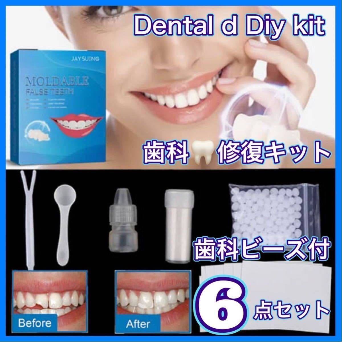 デンタルキットBOX 歯科キット 義歯 仮歯 付け歯 接着剤,歯の欠損を