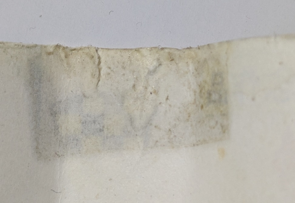 【全初版】ブラック・ジャック　１～５巻　手塚治虫　少年チャンピオン・コミックス_8