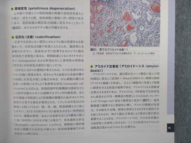 解明 病理学 病気のメカニズムを解く／医歯薬出版株式会社 通販 病気
