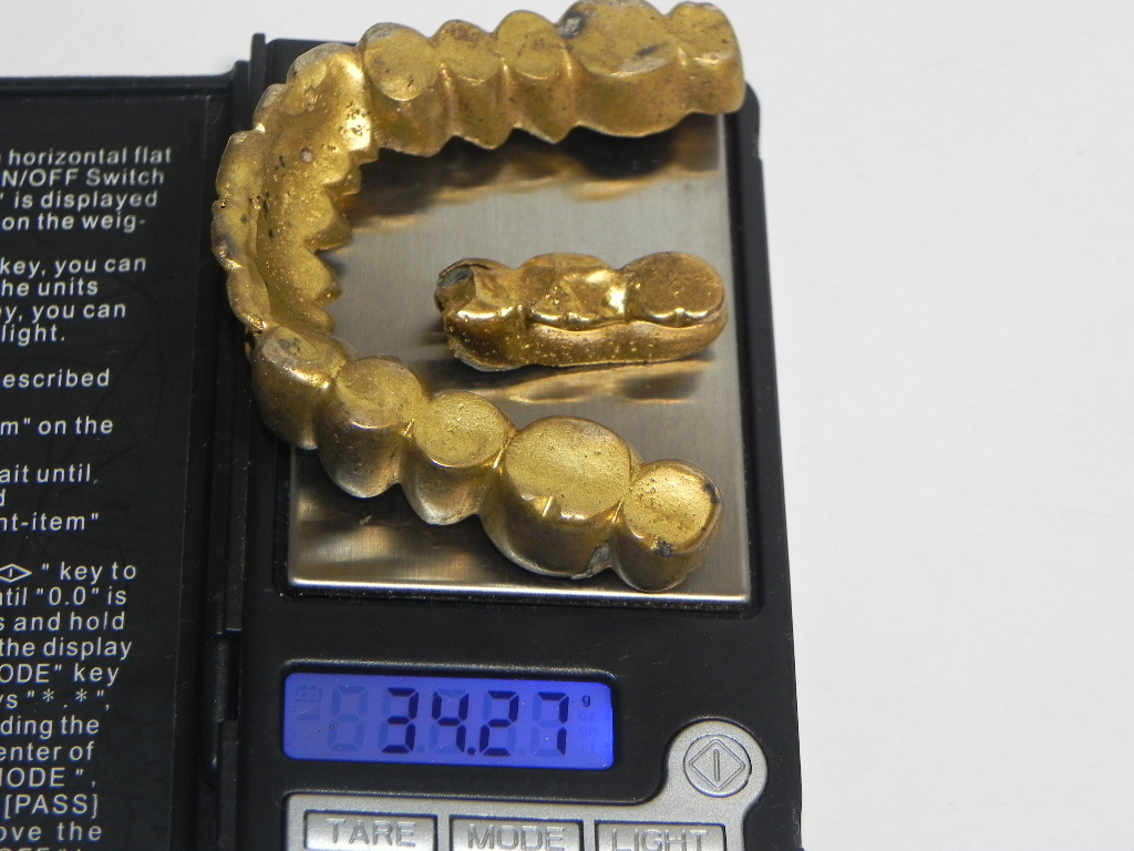 歯科サンプル　金属床義歯　模型付き　歯科医院 入れ歯 歯科 サンプル 見本 模型 総義歯 | 補綴 フルデンチャー 説明
