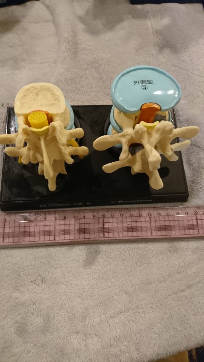 人体模型13点セット 医療教育ツール 医療用 医療 整形外科 整体 整骨院 接骨院_4