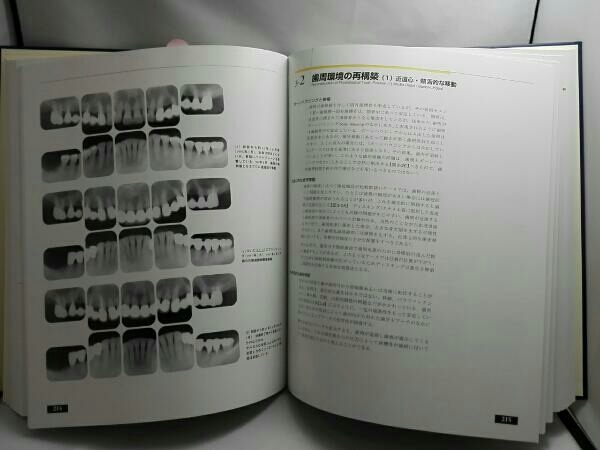 筒井 : 包括歯科臨床 | 祐介 照子, 包括歯科臨床II 顎口腔機能の診断と