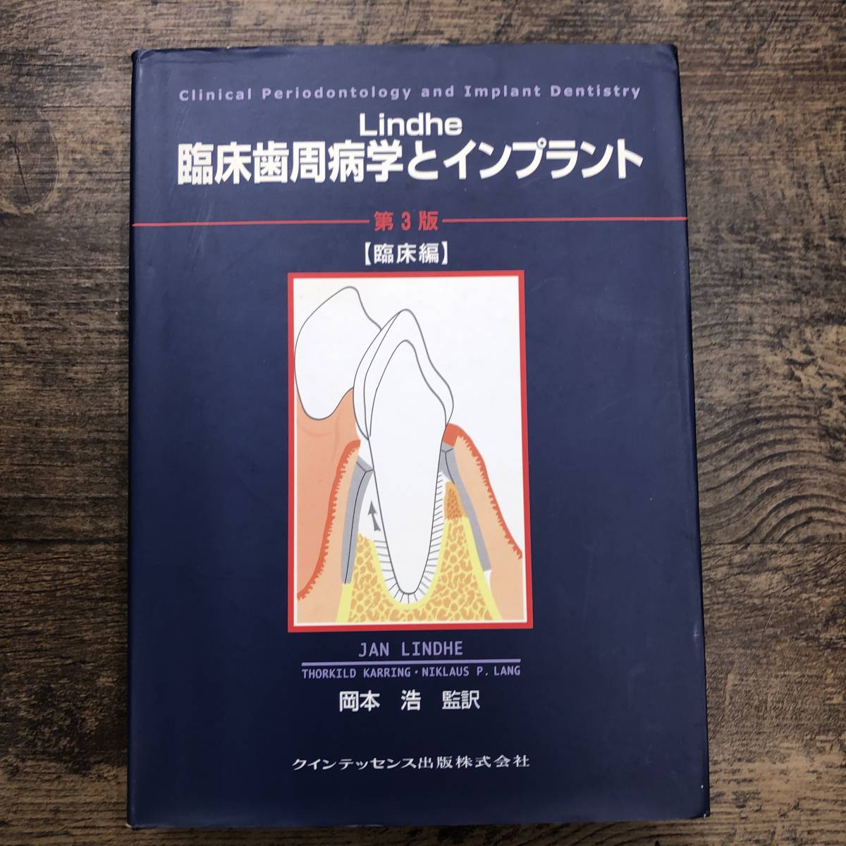 Z-4215□Lindhe臨床歯周病学とインプラント 臨床編 第3版
