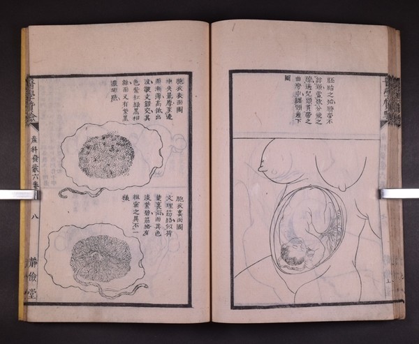 医学質験義集産科発蒙 4冊 医書 片倉鶴陵 寛政十一年 片倉元周 産科学 和本 古文書