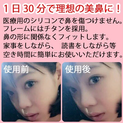 昼用 夜用 ノーズクリップ 2個セット もっと高く 鼻矯正 付けるだけ 鼻美人 鼻クリップ 鼻プチ ブタ鼻 団子鼻 ビューティー ヘルスケア 売買されたオークション情報 Yahooの商品情報をアーカイブ公開 オークファン Aucfan Com