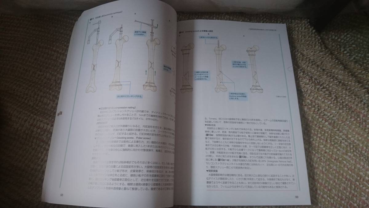 下肢の骨折・脱臼 手技のコツ&トラブルシューティング