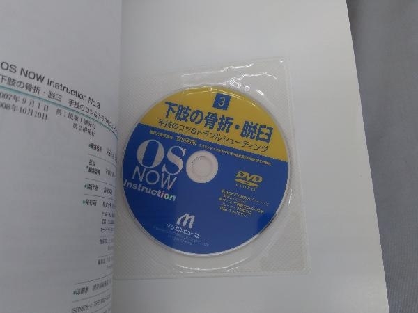 下肢の骨折・脱臼 手技のコツ&トラブルシューティング 医学 本、雑誌