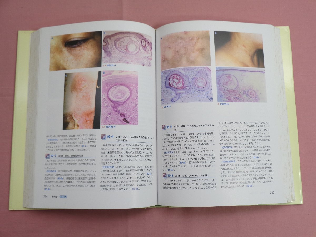 皮疹の数・大きさ・分布からみた皮膚科学 症例と最新情報 皮疹の数