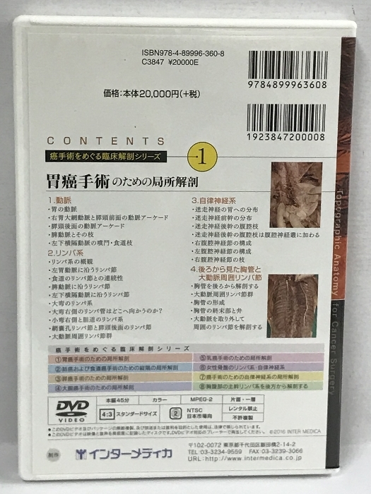 胃癌手術のための局所解剖 癌手術をめぐる臨床解剖シリーズ 1 インター 