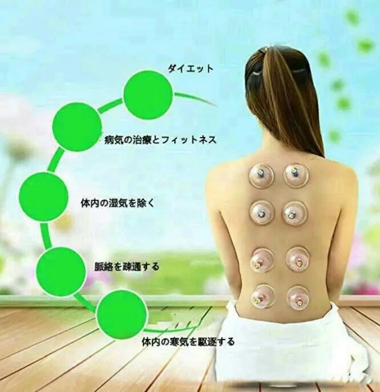 カッピングカップ 吸い玉 拔罐器 32個入り 血液循環 疲れ 血行 健康グッズ_3