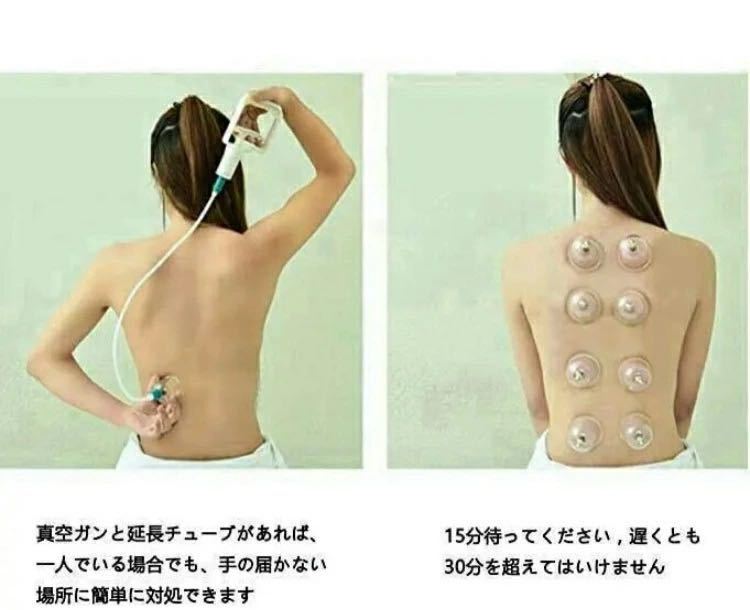 カッピングカップ 吸い玉 拔罐器 32個入り 血液循環 疲れ 血行 健康グッズ_4
