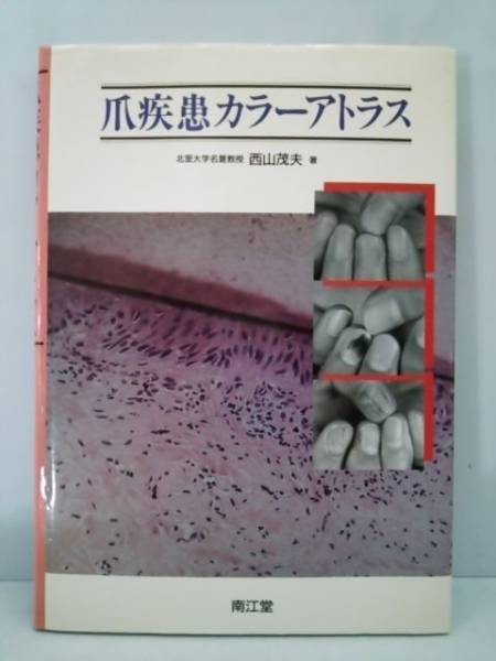 爪疾患カラーアトラス 西山茂夫著 南江堂 1993年発行 西山 茂夫