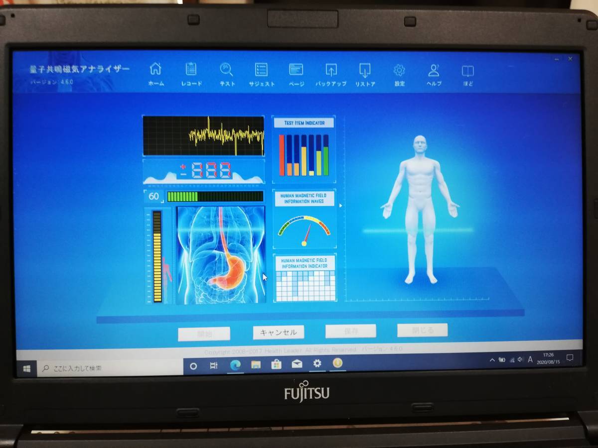 QRM Health Analyzer（量子磁気共鳴ヘルスアナライザー）☆ノートPC