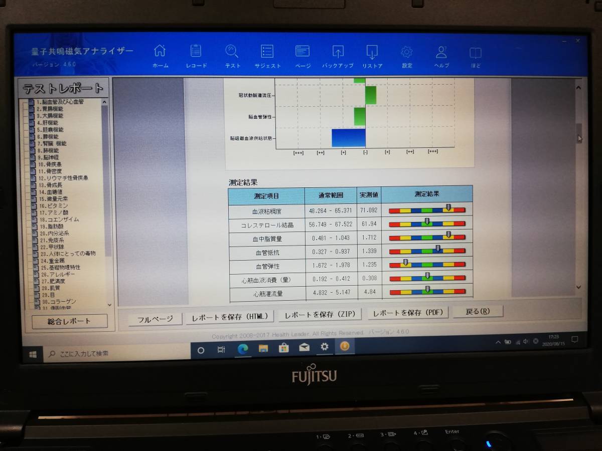 QRM Health Analyzer（量子磁気共鳴ヘルスアナライザー）☆ノートPC