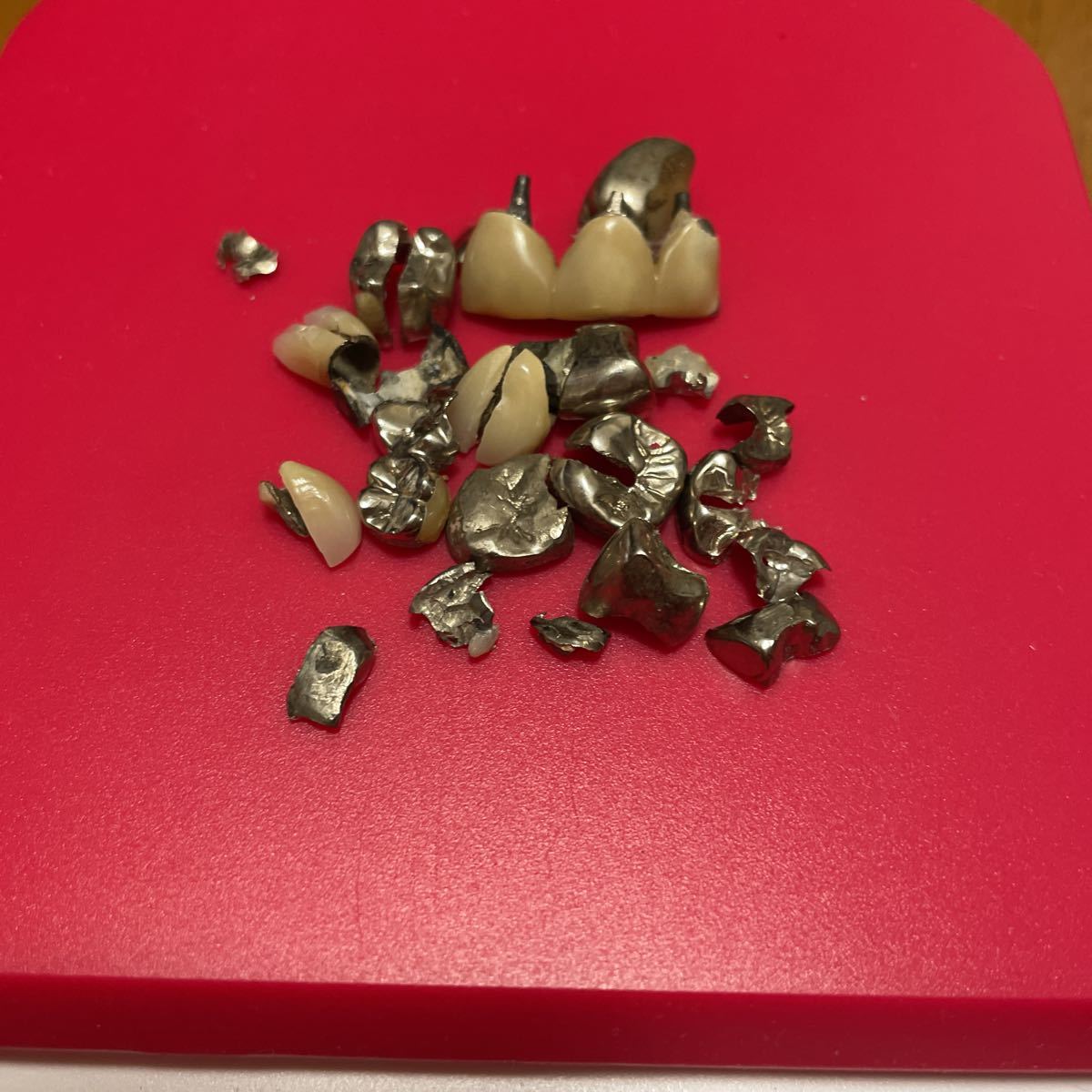 歯科　パラ　除去冠　20g 歯科 金銀パラジウム 撤去冠 20g 【公式通販】