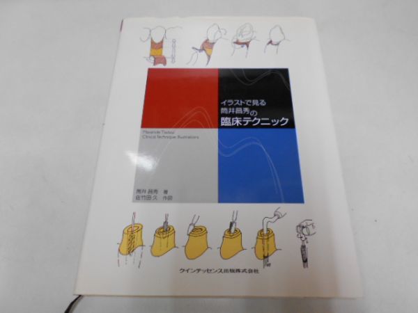 イラストで見る筒井昌秀の臨床テクニック 包括歯科臨床 イラストで見る