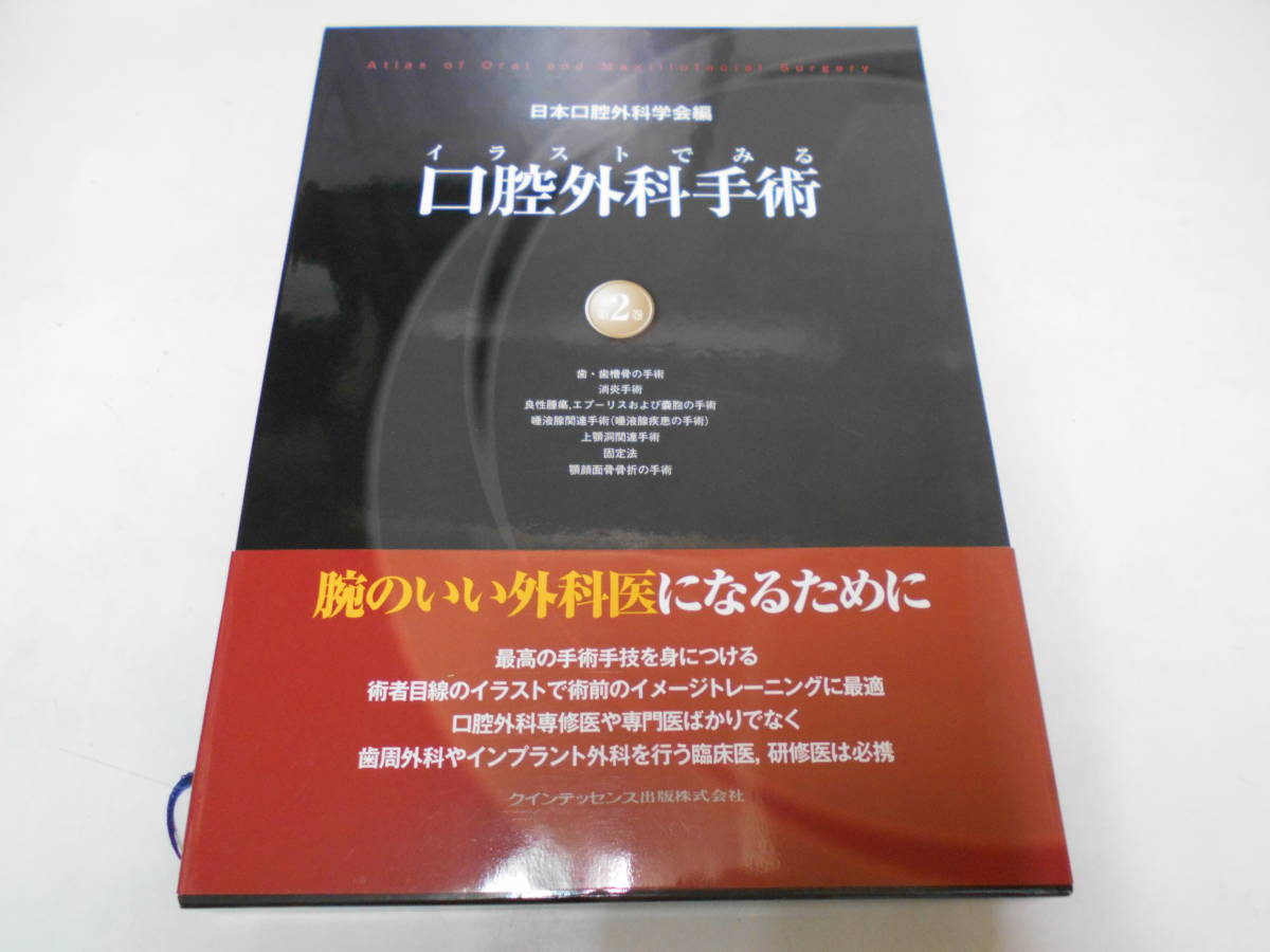イラストでみる口腔外科手術 第2巻 - | クインテッセンス出版 日本口腔