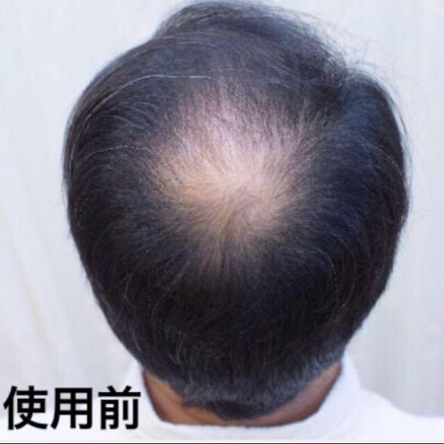 | ヘアーファンデーションつむじ隠し、薄毛隠し 増毛パウダー、生え際 増毛パウダー グレー100g パウダー｜つむじの薄毛隠し・増毛 薄毛 薄毛ヘアパウダー +詰め替え容器 ヘアリドゥ 増毛パウダーアートミクロン 薄毛増毛ふりかけパウダー詰め替え用抜け毛分け目白髪ハゲ隠しファンデ わずか１０秒で薄毛を自然に増毛！ 薄毛を視覚的に増毛 増毛 薄毛カバーパウダー｜女性向けでドラッグストアなどで買える人気