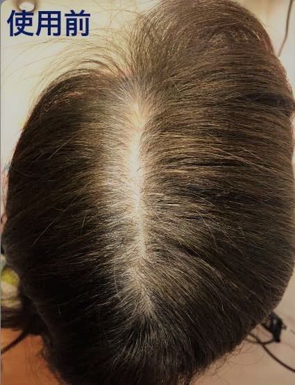 | ヘアーファンデーションつむじ隠し、薄毛隠し 増毛パウダー、生え際 増毛パウダー グレー100g パウダー｜つむじの薄毛隠し・増毛 薄毛 薄毛ヘアパウダー +詰め替え容器 ヘアリドゥ 増毛パウダーアートミクロン 薄毛増毛ふりかけパウダー詰め替え用抜け毛分け目白髪ハゲ隠しファンデ わずか１０秒で薄毛を自然に増毛！ 薄毛を視覚的に増毛 増毛 薄毛カバーパウダー｜女性向けでドラッグストアなどで買える人気