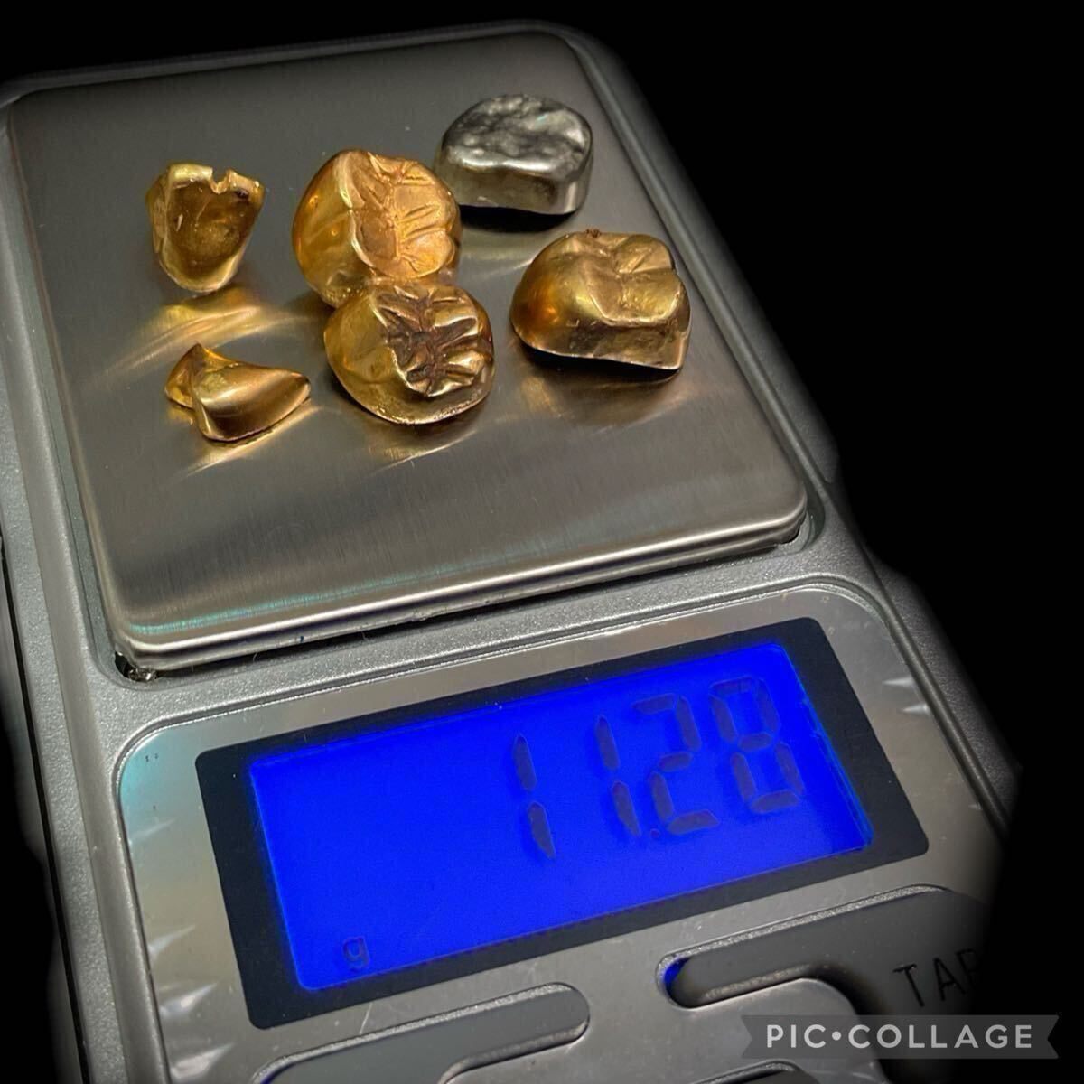 金歯？ 3種類　64g 56g 4g 金歯 gの値段と価格推移は？｜223件の売買データから金歯 gの価値が