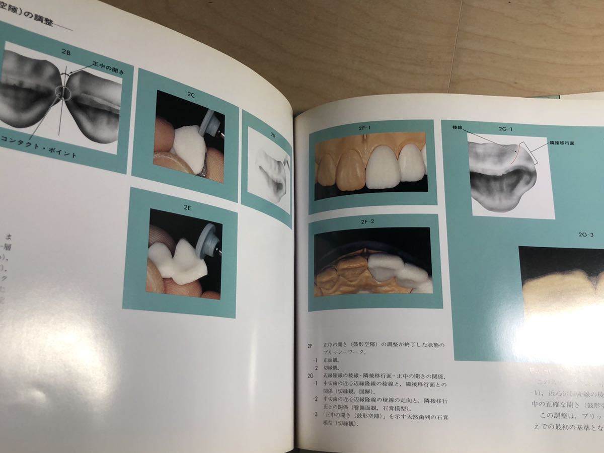 天然歯牙に学ぶ形態学 ネイチャーズ・モルフォロジー 片岡繁夫 - 24